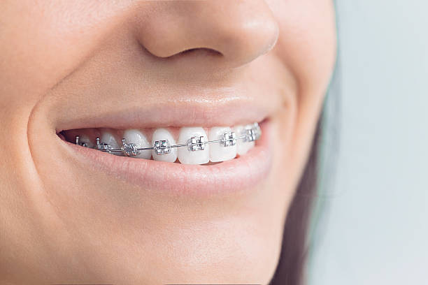 Best Teeth Whitening  in Bull Valley, IL